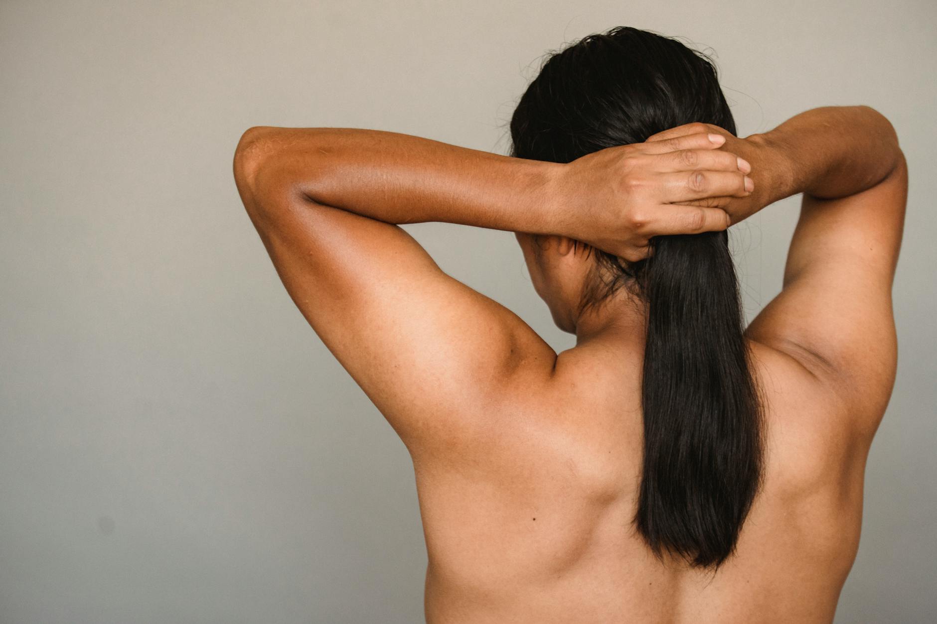 Where Hidradenitis Suppurativa Appears on the Body